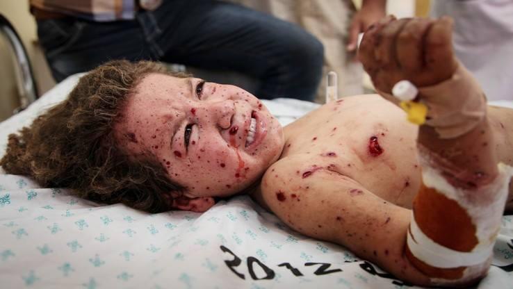 حرب إسرائيل تشّوه وجوه وأرواح أطفال غزة