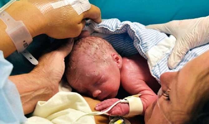 امرأة سويدية تضع أول مولود من رحم مزروع
