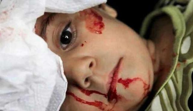 مجلس الأمن أراد نقاش عذابات أطفال العالم فلم يخرج بأي قرار