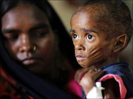 وزيرة: قرار مودي بخفض الميزانية أضر بجهود الهند لمكافحة سوء التغذية
