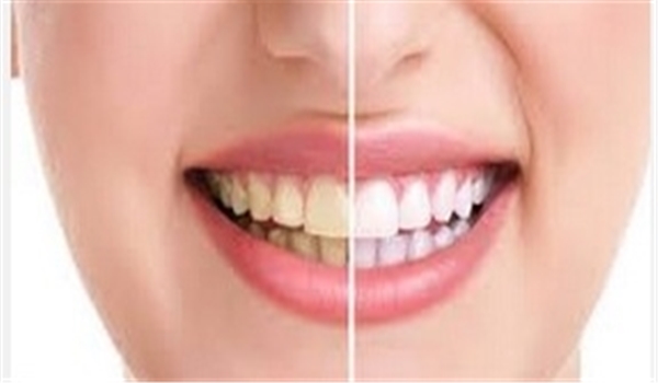 علماء: تجديد الاسنان