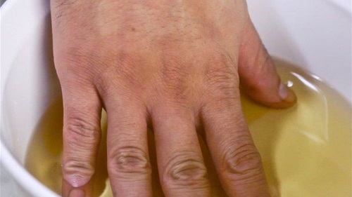 خل التفاح... لازلة