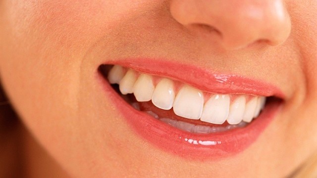 دراسة تدحض نظرية تسبب بعض السكريات في تسوس الأسنان