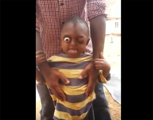بالفيديو: طفل افريقي يخرج عينه من محجرها
