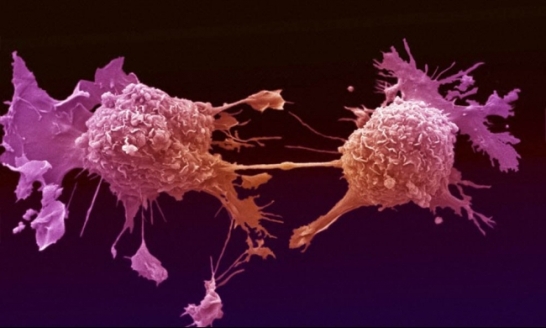 جهاز جديد لتدمير الخلايا السرطانية