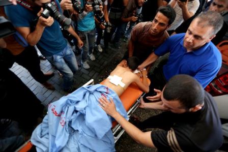  إصابة طفل بجروح طفيفة