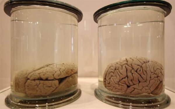 عرض عينات من دماغ “أينشتاين” في متحف أمريكي رغم إحراق جثته قبل 60 عاما
