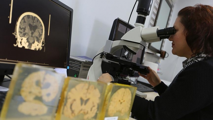 الكسل يعجّل بشيخوخة الدماغ البشرية
