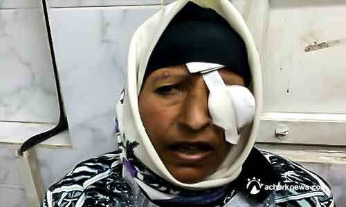 حدث في مصر ! .. 60 دولارا تعويضا للمصابين بالعمى بعد حقنهم بمادة محرمة
