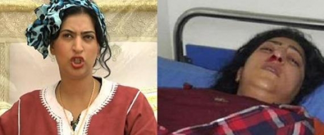 فيديو...ممثلة مغربية تتعرض لكسر في أنفها بسبب شجار يخص سمعتها.. !
