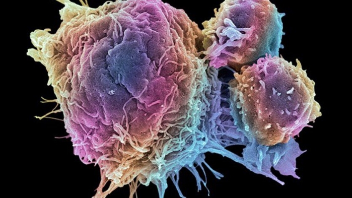 علاج ثوري لتقوية المناعة لدى الأشخاص المصابون بالسرطان