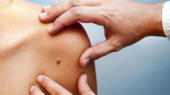 علامات تنذر بسرطان