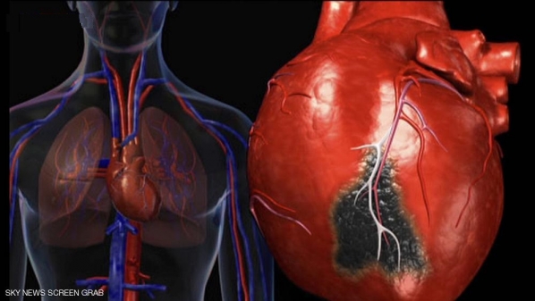 دراسة...صحة قلبك مرتبطة بمهنتك
