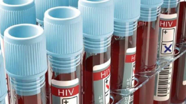 الصحة العالمية: نقص الاختبارات يقوض جهود مكافحة الإيدز