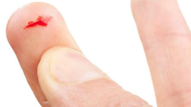 لماذا نشعر بألم شديد عند الإصابة بجرح نتيجة الاحتكاك بحواف الورق؟