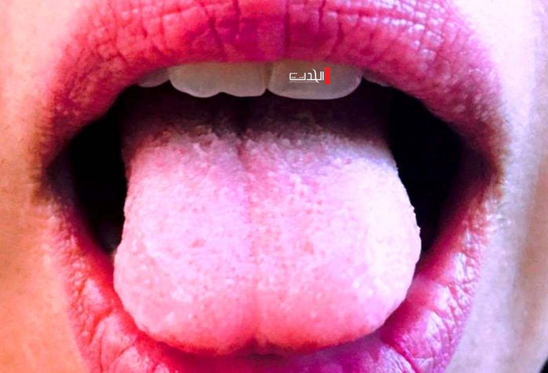  من شكل لسانك اكتشف