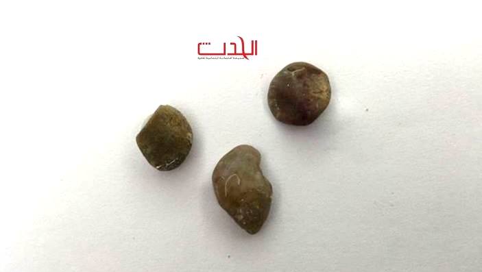بدون جراحة تخلص من