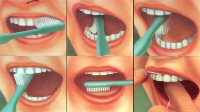 أطباء ينصحون بالإقلال من تنظيف الأسنان!
