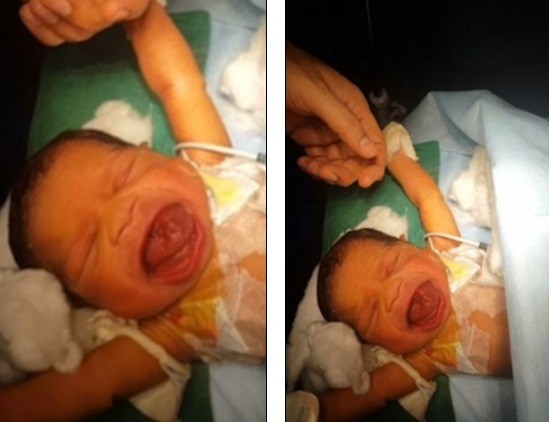 طفل يصدم الأطباء بعد الولادة.. ما أصيب به نادر!
