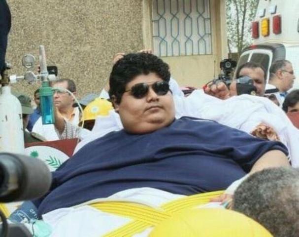  4 سنوات من العلاج.. شاهد كيف أصبح أضخم شاب سعودي