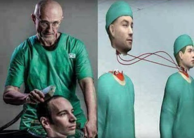 ما هو سبب استحالة عملية نقل الرأس؟