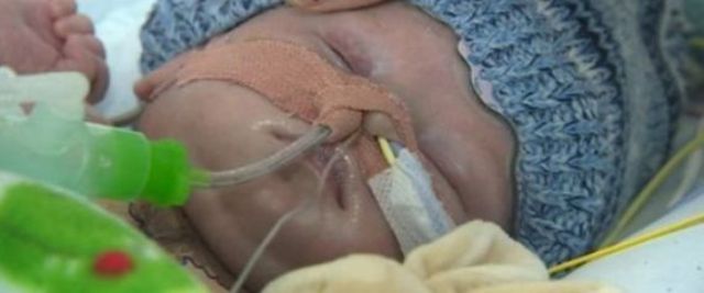 عائلة مجهولة تبرعت لهذا الرضيع بقلب وأنقذت حياته
