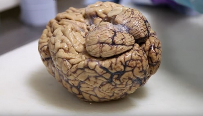 اكتشاف دماغ غامض في جمجمة مقتول
