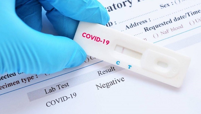 أبرز أخطاء الأطباء والمرضى عند اختبار كوفيد-19