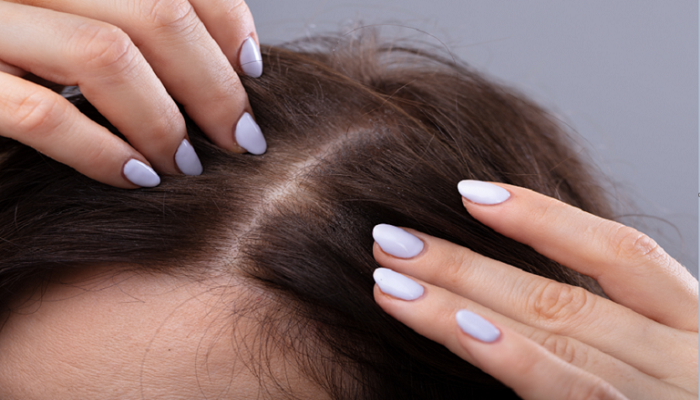 مكملات الحلبة قد تؤدي إلى تحسينات كبيرة في نمو الشعر
