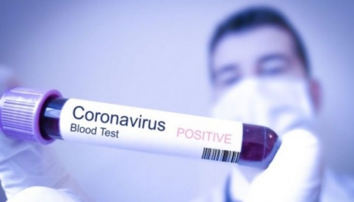 الموافقة على استخدام علاج محتمل لفيروس كورونا في إسرائيل
