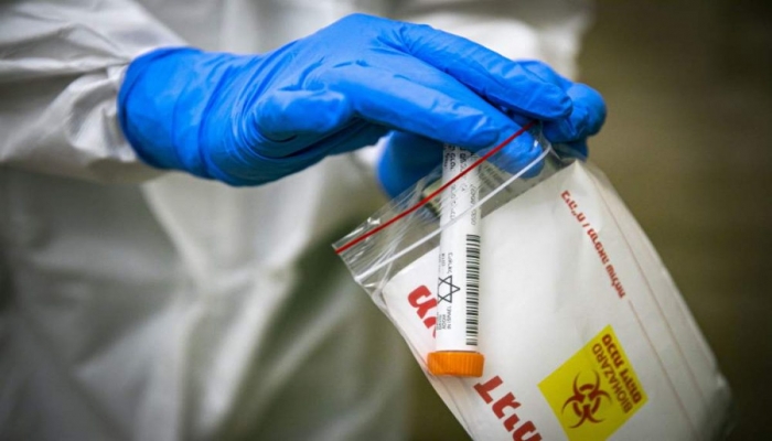 الصحة الإسرائيلية تعلن ارتفاع عدد وفيات واصابات فيروس كورونا
