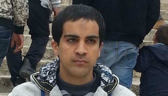 الانتهاء من تشريح