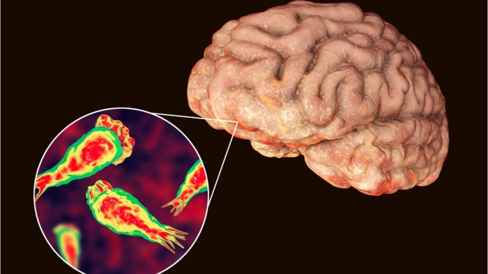 أمريكا: ظهور أميبا آكلة للدماغ في المياه
