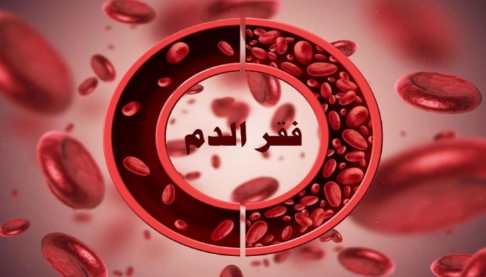 ما علاقة الأواني الحديدية بفقر الدم؟
