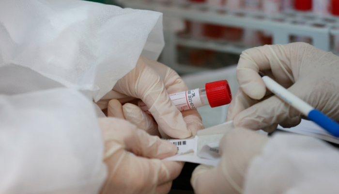 صحة غزة تكشف حصيلة الاصابات اليومية بفيروس كورونا في القطاع
