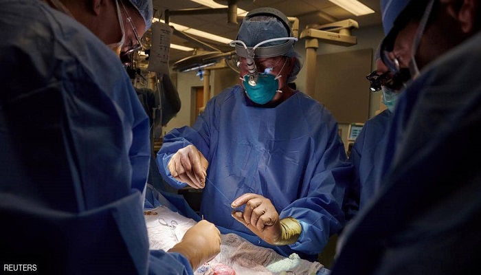 لأول مرة.. جراحون أمريكيون نجحوا بزراعة كلية خنزير في جسم إنسان
