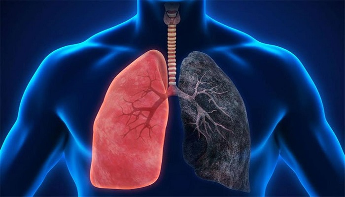 الصحة: 70% من مرضى سرطان الرئة في فلسطين هم من المدخنين والمدخنين السابقين