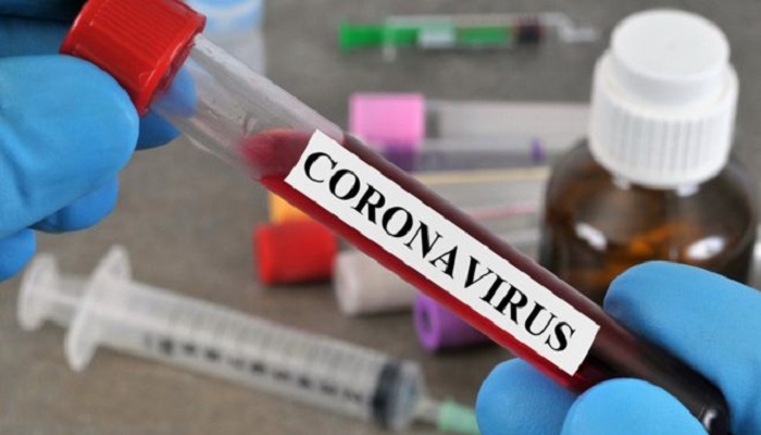 وفاة و93 إصابة جديدة بفيروس كورونا و282 حالة تعافٍ 