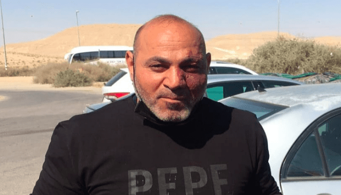 الاحتلال يفرج عن الأسير المقدسي غازي كنعان بعد 11 عاما من الاعتقال
