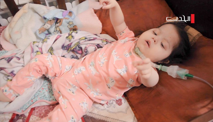 خطأ طبي وإهمال.. الطفلة آية عواشرة فقدت صوتها ونفَسها في غرف عمليات مستشفى رام الله 

