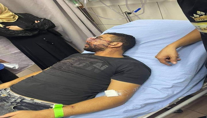الاحتلال يتسبب بتشوه في وجه الجريح أبو زيتون وضرر كبير في عينه