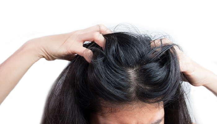 11 مكونا شائعا ولكنه ضار في الشامبو يجب تجنبه لمكافحة تساقط الشعر
