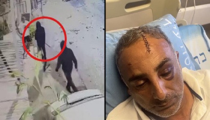 شرطة الاحتلال تمتنع عن فتح تحقيق في الاعتداء على الحاج محمد زهران 

