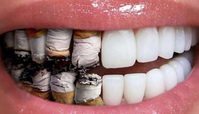  التأثير السلبي للتدخين على صحة الفم والأسنان