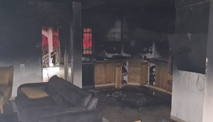 12 إصابة إثر حريق في منزل مأهول بالناصرة
