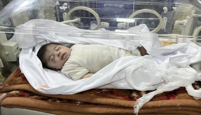 استشهاد طفلة في مجمع الشفاء الطبي نتيجة سوء التغذية
