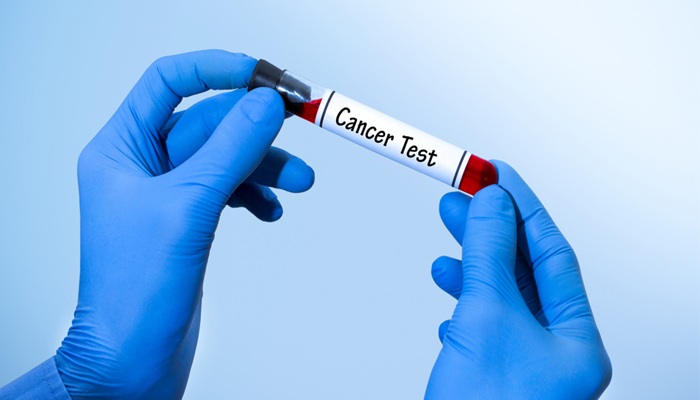 أطباء يحذرون: 6 أعراض