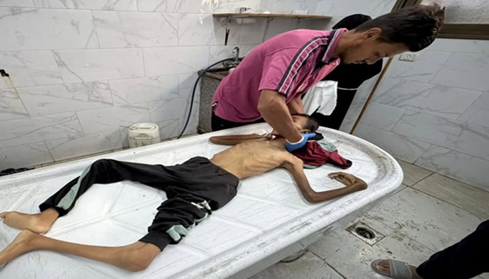في غضون 24 ساعة: وفاة 10 أشخاص بسبب المجاعة وسوء التغذية في قطاع غزة
