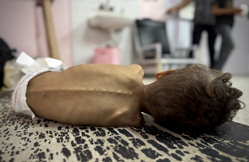 ارتفاع حصيلة ضحايا التجويع في غزة إلى 263 شخصا بينهم 112 طفلا

