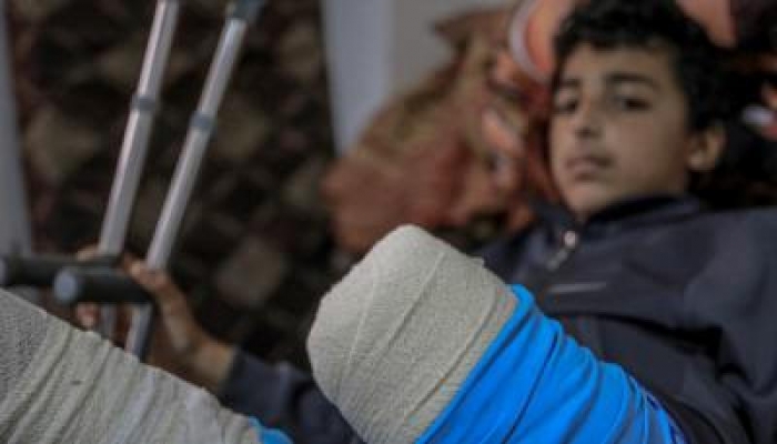 لجنة أممية: 21 ألف طفل في غزة يعانون من إعاقات منذ بدء الحرب
